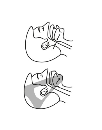 Bande Anti-ronflements Stosnore InnovaGoods