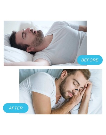 Engangs Næsebånd Mod Snorken - Forbedr Åndedrættet