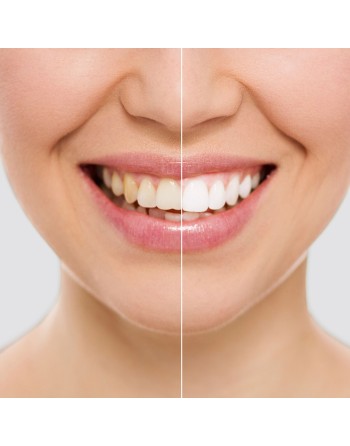 Lápiz Blanqueador Dental Witen InnovaGoods 2 Unidades