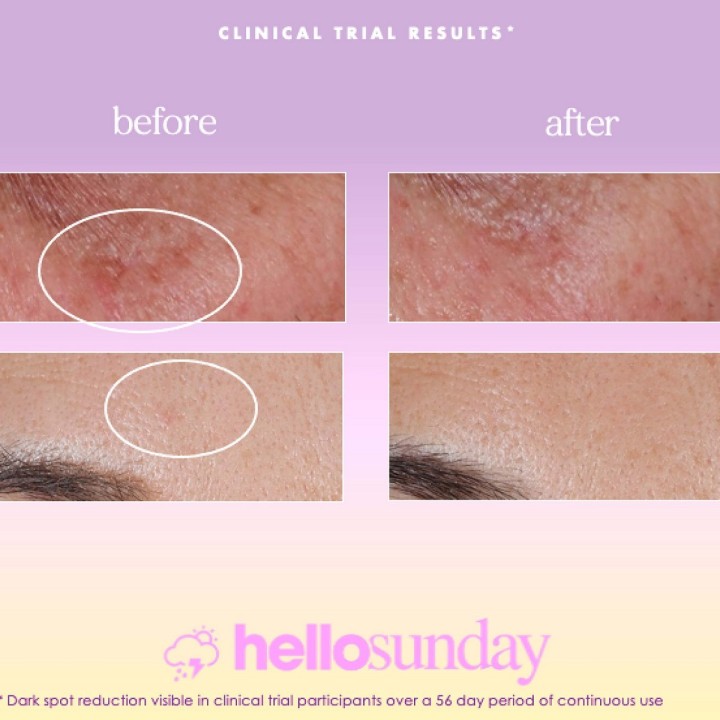 Siero Viso Hello Sunday The One That Makes You Glow Dark Spot SPF 40 (30 ml)
