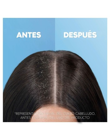 Shampoo Head & Shoulders H&S Clásico 1 L
