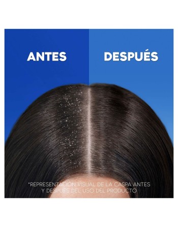 Shampooing Head & Shoulders S Anticaída 1 L