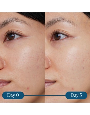 Facial Serum Elemis Dynamic Resurfacing 30 ml