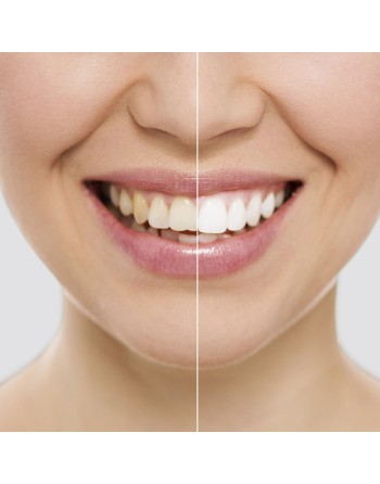 Zahnaufhellungsstreifen Wripes InnovaGoods (Restauriert A)