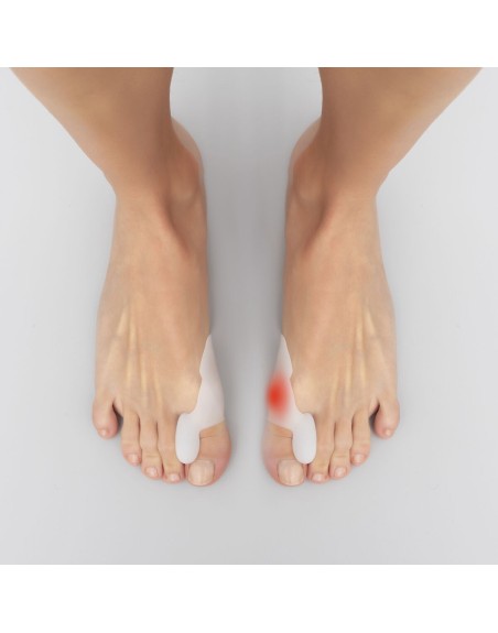 Silikone Bunion Corrector Protector Bunilief InnovaGoods 2 enheder